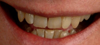 teeth.gif